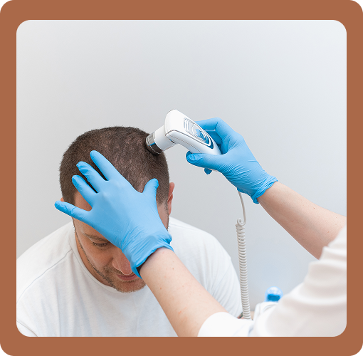 Saç ekimi sonrası bakım